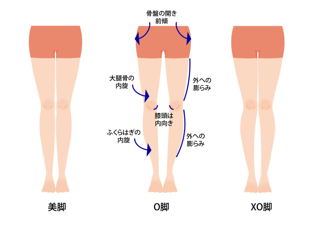 なぜo脚になるのか 施術技術 刈谷の美容整体body S K 筋膜リリース 骨盤矯正 O脚
